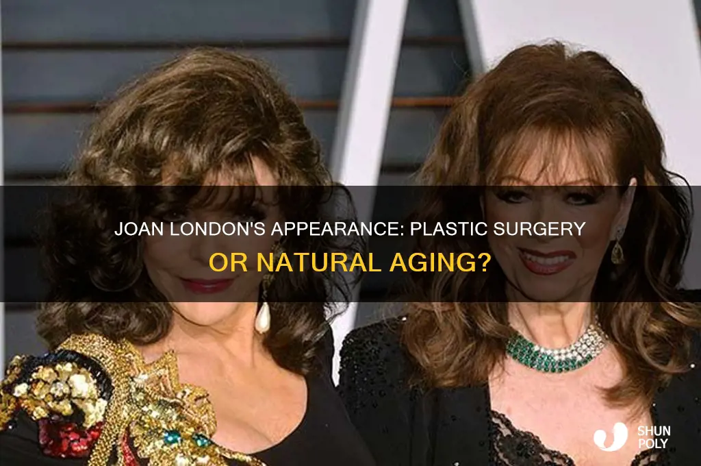has joan london had plastic surgery or injections