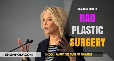 Joan Lunden's Transformation: Plastic Surgery Speculations and Truths Revealed