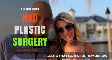 Joan Vasso's Transformation: Plastic Surgery Rumors Explored and Analyzed
