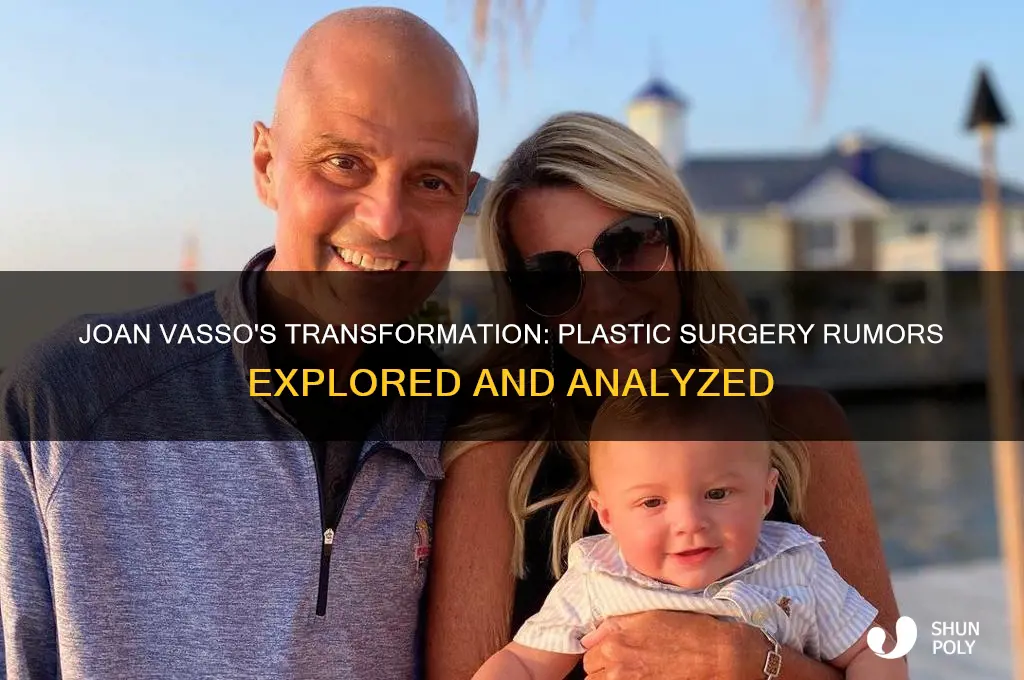has joan vasso had plastic surgery