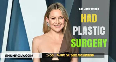 Joan Vassos Plastic Surgery: Fact-Checking the Rumors and Speculations