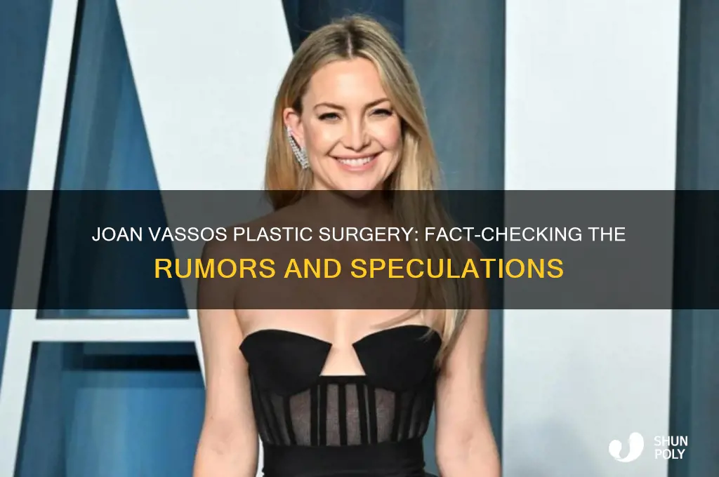 has joan vassos had plastic surgery