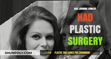 Joanna Lumley's Ageless Beauty: Plastic Surgery Speculations Explored