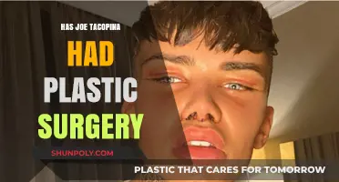 Joe Tacopina Plastic Surgery: Fact or Fiction? Uncovering the Truth