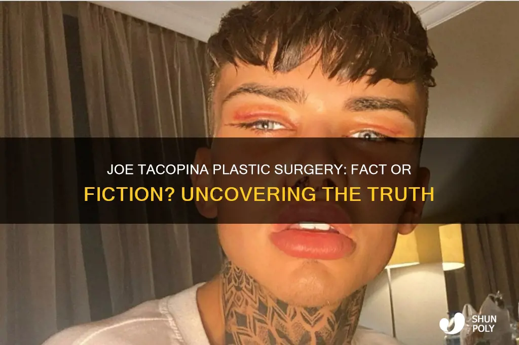 has joe tacopina had plastic surgery