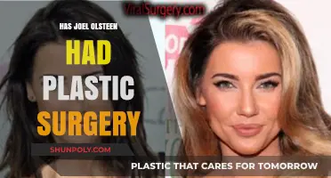 Joel Osteen's Appearance: Plastic Surgery Speculations and Facts Revealed
