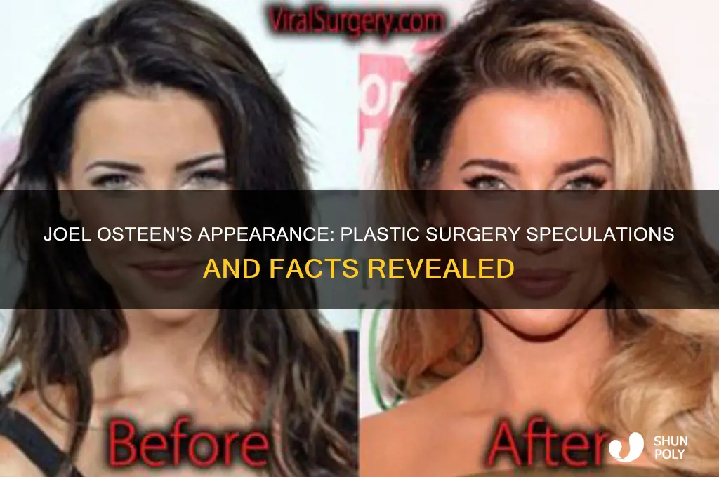 has joel olsteen had plastic surgery