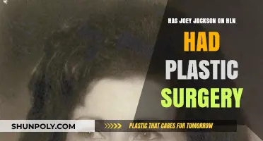 Joey Jackson's Appearance: Plastic Surgery Speculations and HLNs Take