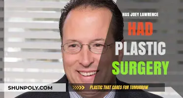 Joey Lawrence Plastic Surgery: Fact or Fiction? Unveiling the Truth
