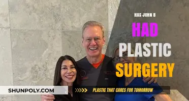 John B's Transformation: Plastic Surgery Rumors Explored and Debunked