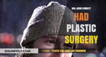 John Corbett's Appearance: Plastic Surgery Rumors Explored and Debunked
