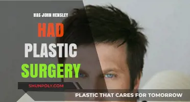 John Hensley's Transformation: Plastic Surgery Rumors Explored and Debunked
