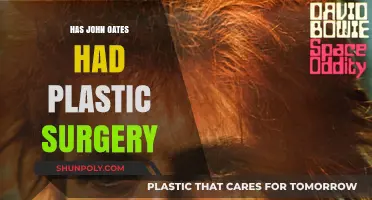 John Oates Plastic Surgery: Fact-Checking the Rumors and Speculations