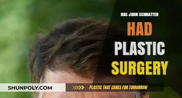 John Schnatter's Transformation: Plastic Surgery Rumors Explored and Debunked