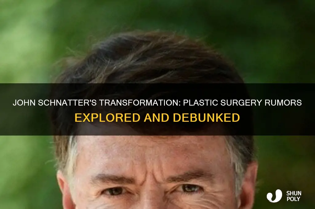 has john schnatter had plastic surgery