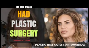 John Stamos Plastic Surgery: Fact-Checking the Rumors and Speculations