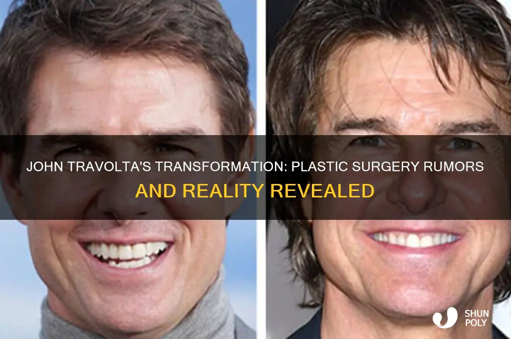 has john travolta get plastic surgery