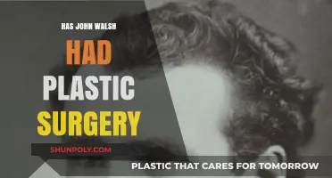 John Walsh Plastic Surgery: Fact-Checking Rumors and Speculations