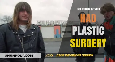 Johnny Rzeznik's Transformation: Plastic Surgery Rumors Explored