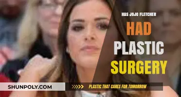 JoJo Fletcher's Transformation: Plastic Surgery Rumors Explored