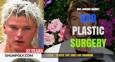 Jordan Barrett Plastic Surgery: Fact or Fiction? Unveiling the Truth