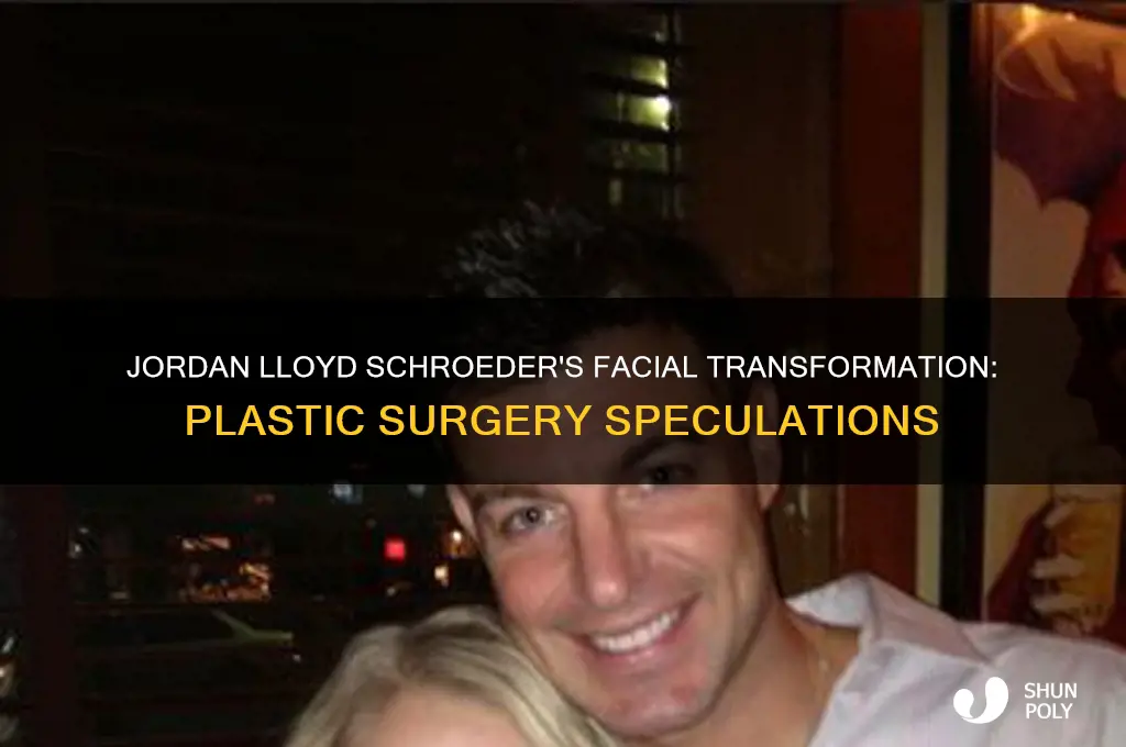 has jordan lloyd schroeder had plastic surgery on face