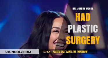 Jordyn Woods Plastic Surgery: Fact-Checking Transformation Rumors and Truths