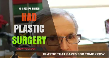 Joseph Prince Plastic Surgery: Fact-Checking the Rumors and Speculations
