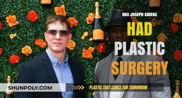 Has Joseph Sikora Undergone Plastic Surgery? Unveiling the Truth