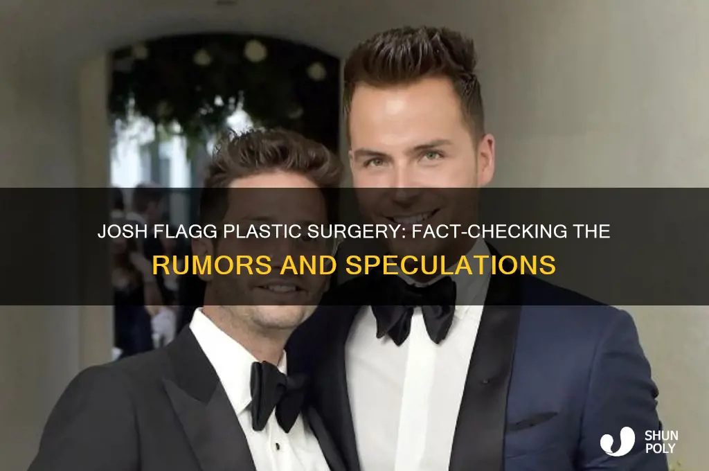 has josh flagg had plastic surgery