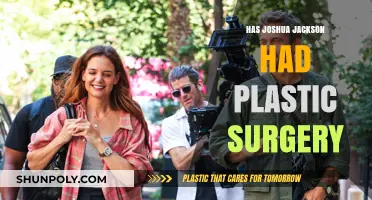 Has Joshua Jackson Had Plastic Surgery? Uncovering the Truth