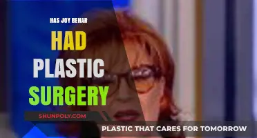 Has Joy Behar Had Plastic Surgery? Unveiling the Truth