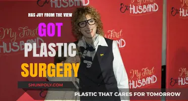 Has Joy Behar Undergone Plastic Surgery? The View Host's Transformation