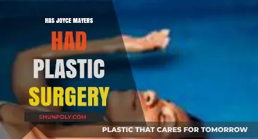 Joyce Meyer's Appearance: Plastic Surgery Speculations and Facts Revealed