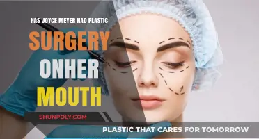 Joyce Meyer's Mouth Transformation: Plastic Surgery Speculations Explored