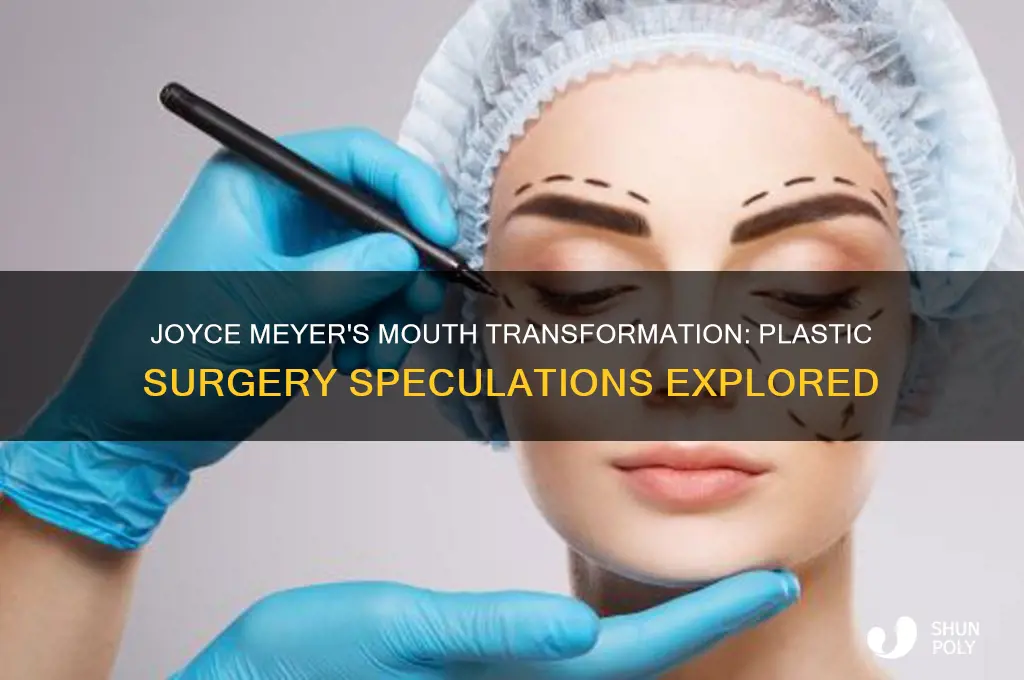 has joyce meyer had plastic surgery onher mouth