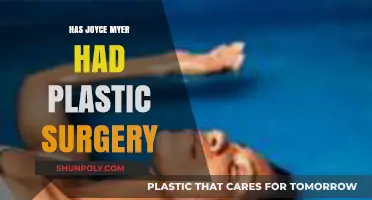 Joyce Meyer's Appearance: Plastic Surgery Speculations and Truths Revealed