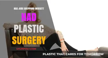Judi Sheppard Missett's Transformation: Plastic Surgery Speculations Explored