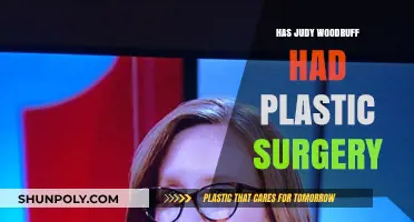 Judy Woodruff Plastic Surgery: Fact-Checking Rumors and Speculations