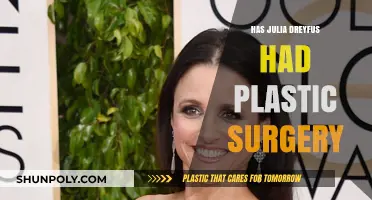 Julia Louis-Dreyfus Plastic Surgery: Fact-Checking the Rumors and Speculation
