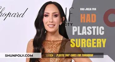 Has Julia Fox Had Plastic Surgery? Unveiling the Truth