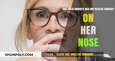 Julia Roberts' Nose: Natural Beauty or Plastic Surgery?