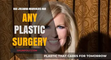 Julianna Margulies Plastic Surgery: Fact-Checking the Rumors and Speculations