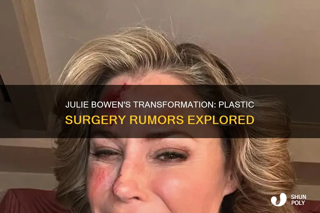 has julie bowen had plastic surgery