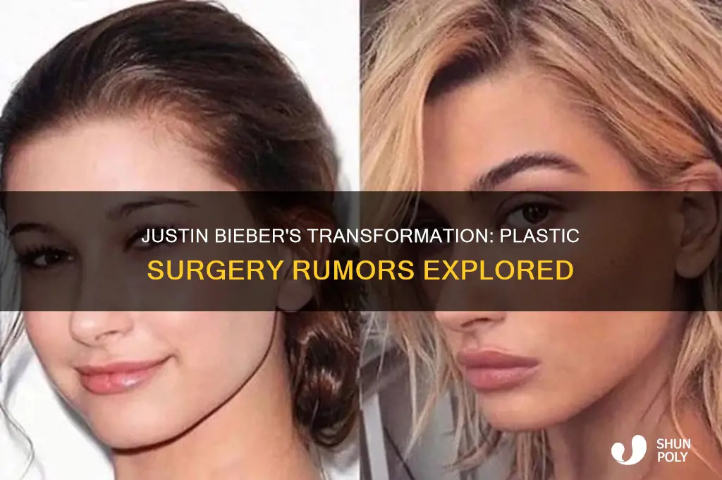 has justin bieber had plastic surgery