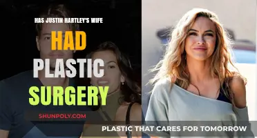 Justin Hartley's Wife: Plastic Surgery Rumors Explored and Debated