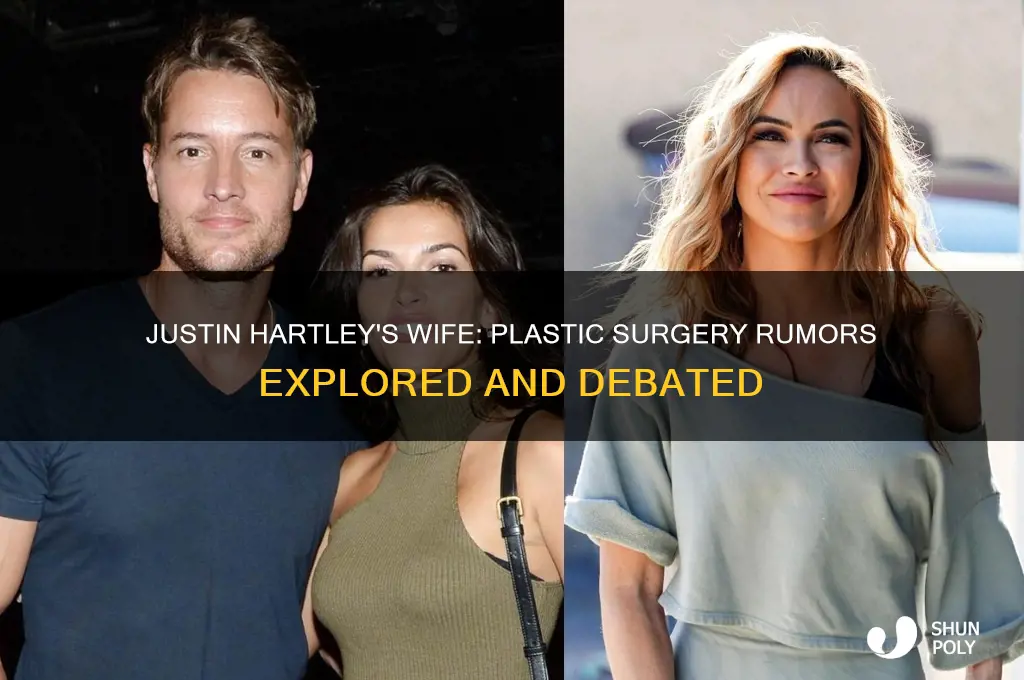 has justin hartley