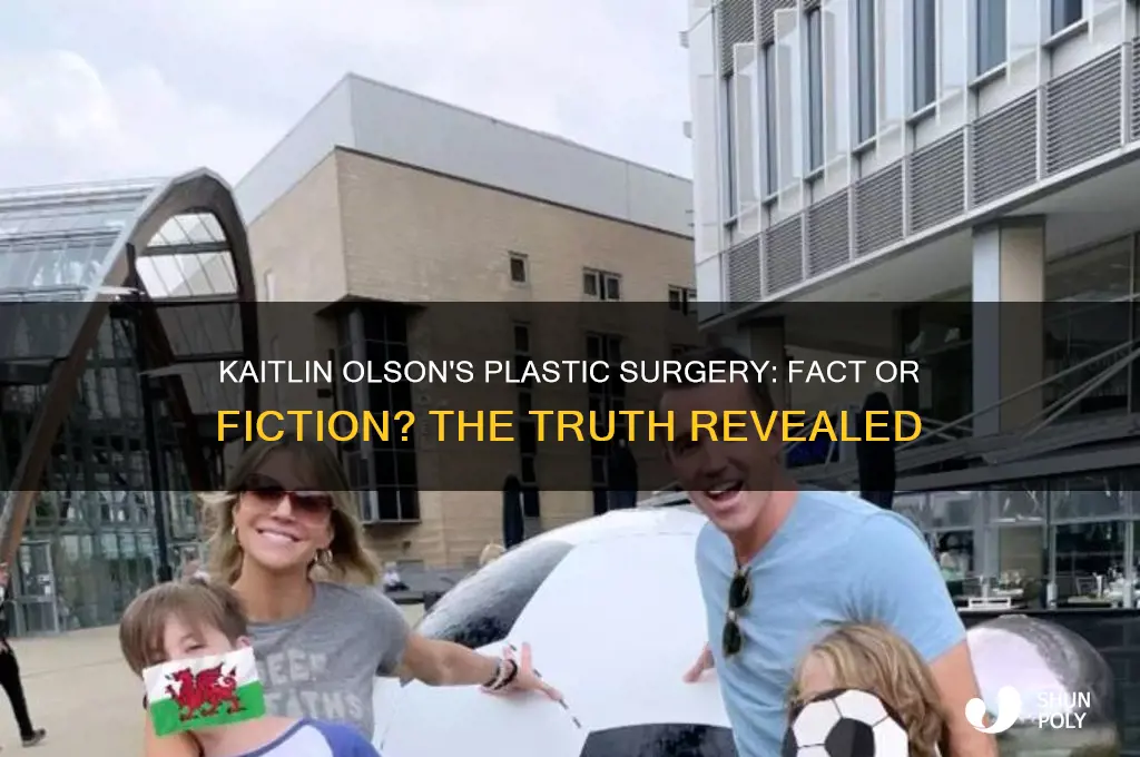 has kaitlin olson admitted to plastic surgery