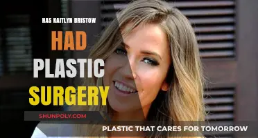 Kaitlyn Bristowe's Transformation: Plastic Surgery Speculations and Truths