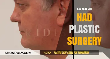 Kane Lim Plastic Surgery: Fact-Checking the Rumors and Speculations